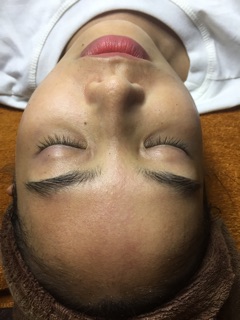 HCM [VOUCHER] DETOX DA CHUYÊN SÂU Skin House