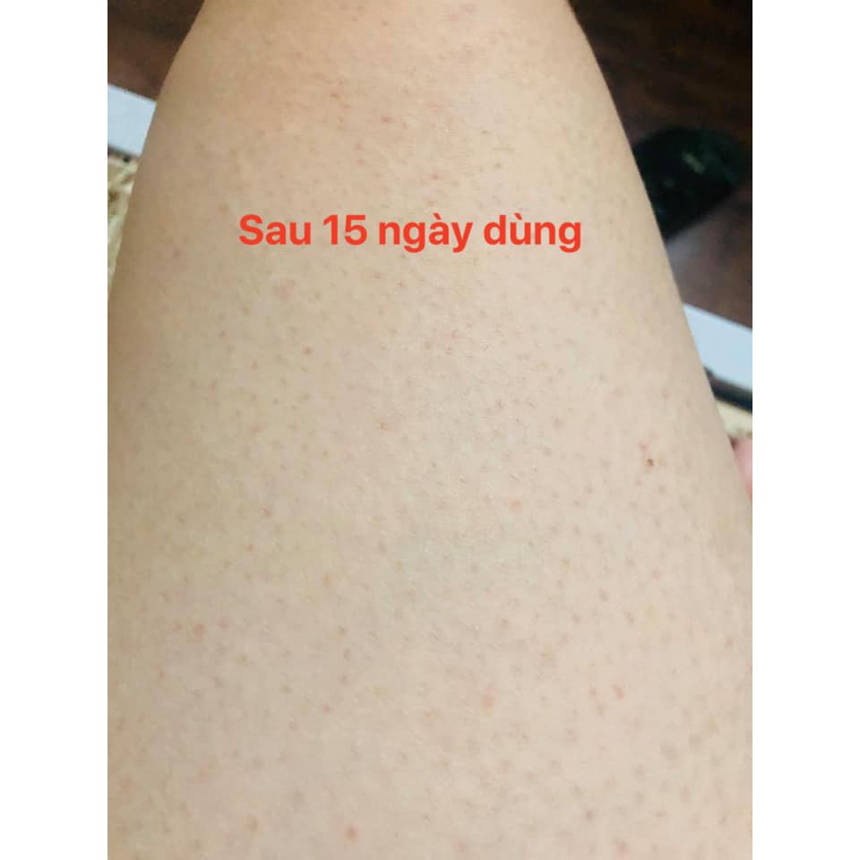 Xà bông cục, xà phòng loại bỏ viêm nang lông - handmade 130g HSD 18 tháng