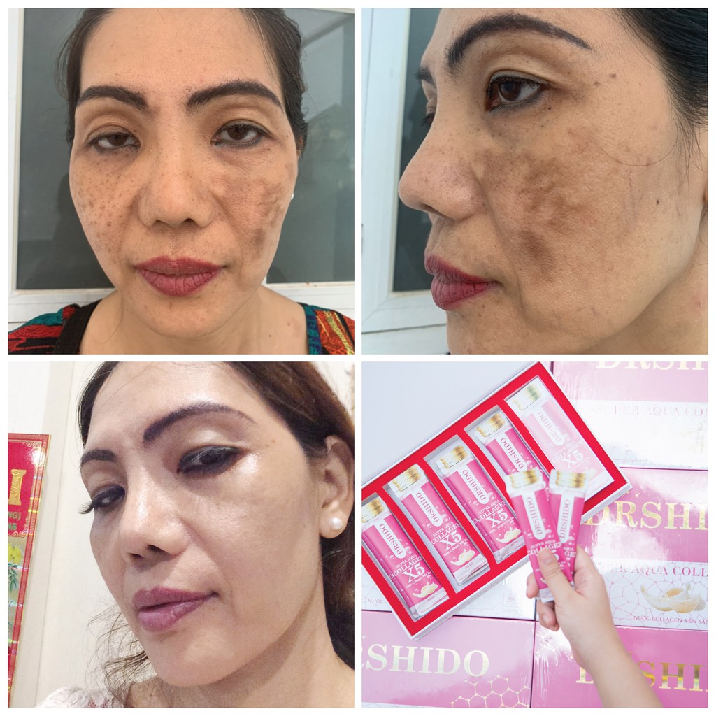 10 gói Nước Collagen Yến Sào Nhật Bản- SUPER AQUA COLLAGEN X5 | BigBuy360 - bigbuy360.vn