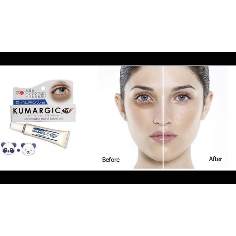 [MẪU MỚI] Kem hỗ trợ giảm thâm quầng mắt Kumargic Eye Nhật Bản