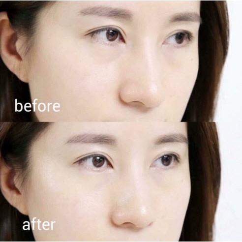 Kem dưỡng mắt AHC Ageless Real Eye Cream