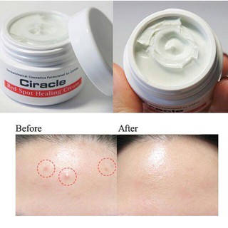 Kem mụn trứng cá CIRACLE Red Spot Cream