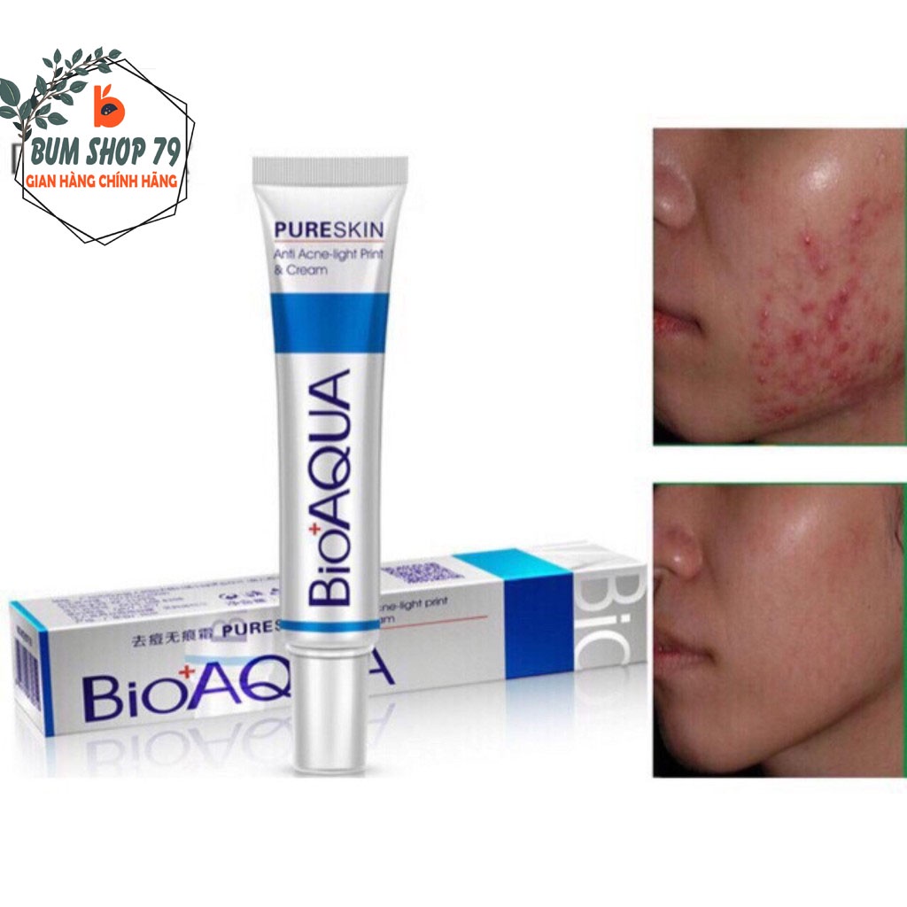 Kem Mụn Bioaqua Pure Skin Hàng Nội Địa Trung