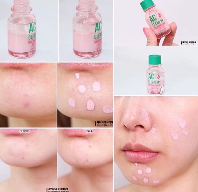 [Mẫu mới] Chấm mụn AC CLEAN UP PINK POWDER SPOT | BigBuy360 - bigbuy360.vn