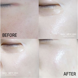 Mặt nạ mediheal Hàn Quốc