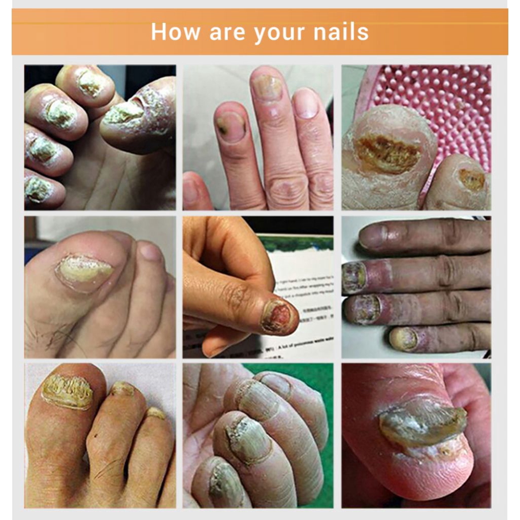 Tinh Chất Phục Hồi Móng Tay / Chân Lanbena Chiết Xuất Hoa Hướng Dương | BigBuy360 - bigbuy360.vn