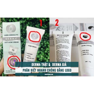 Kem mụn Derma Anti Acne Cream chính hãng giảm mụn, mờ thâm, đầu đen, mụn ẩn, mủ