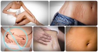 MINI 30ml Kem trị rạn da Clarins stretch marks