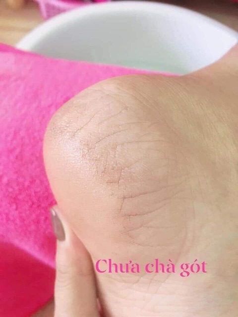 Cây chà gót chân tặng kèm nước là mềm da hiệu quả ngay lần đầu,dễ sử dụng không sợ bén gay chạy máu | BigBuy360 - bigbuy360.vn