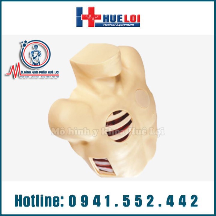 Mô hình thực hành chọc dò tràn khí màng phổi
