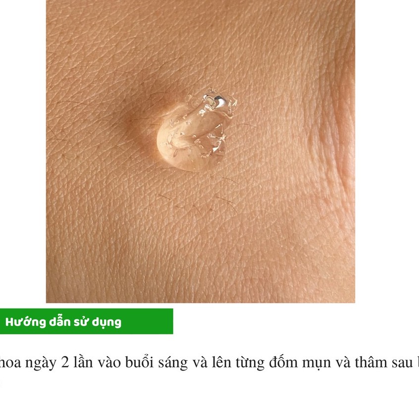 Gel Giảm Mụn Ẩn Và Thâm Gamma Megaduo Gel 15 gram