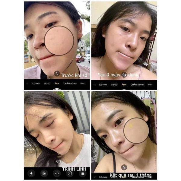 [ CHÍNH HÃNG]SERUM THẢO MỘC XANH | BigBuy360 - bigbuy360.vn