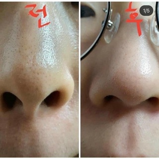 Máy rửa mặt LG
