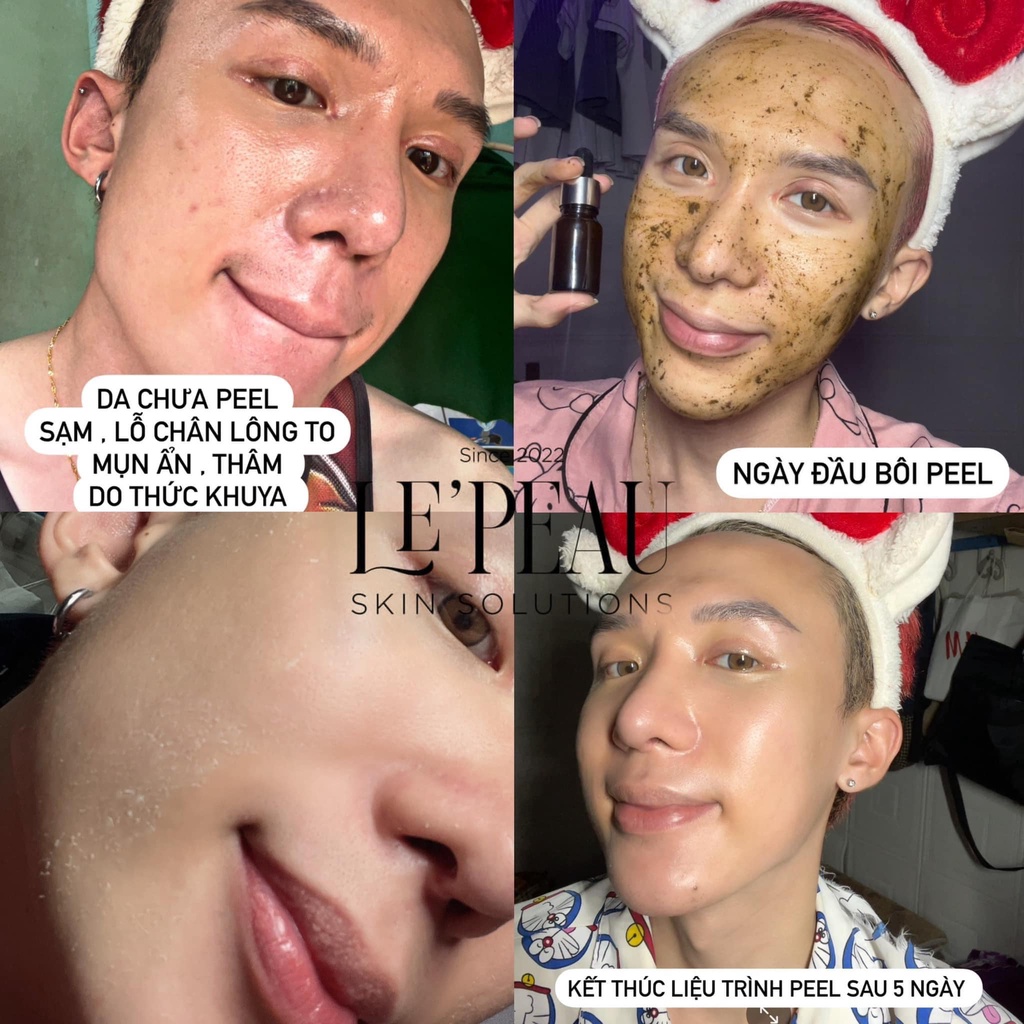 LE’PEAU - Peel da Vi Tảo Retinol  x 2