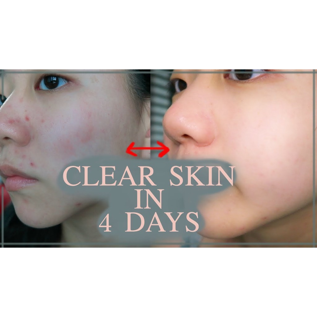 B5 La Roche Posay Cicaplast Braume 40ml, 100ml Kem dưỡng phục hồi làm dịu da La Roche Posay B5 | BigBuy360 - bigbuy360.vn