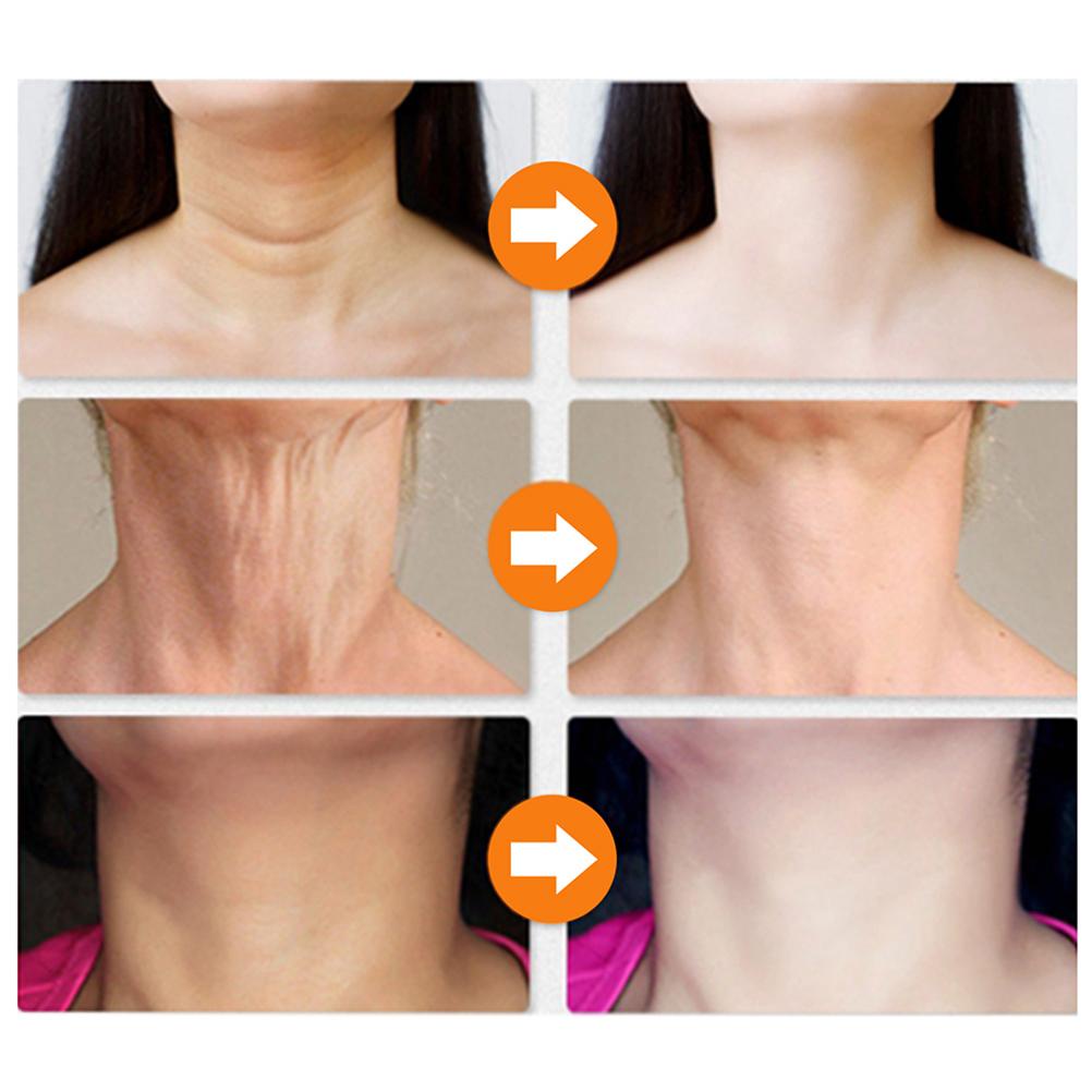 (Hàng Mới Về) Serum Dưỡng Da Mặt Chống Lão Hóa Và Nếp Nhăn | BigBuy360 - bigbuy360.vn