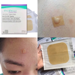Miếng dán về DuoDerm Extra Thin