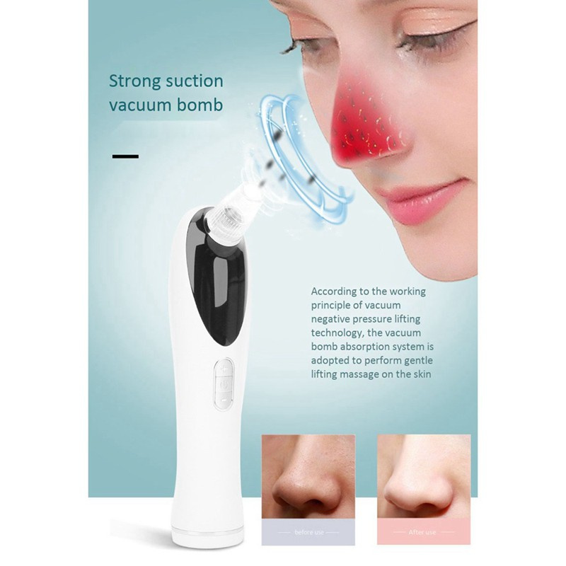 Blackhead Remover Hot Facial Cleanser Beauty Tool Skin Care White