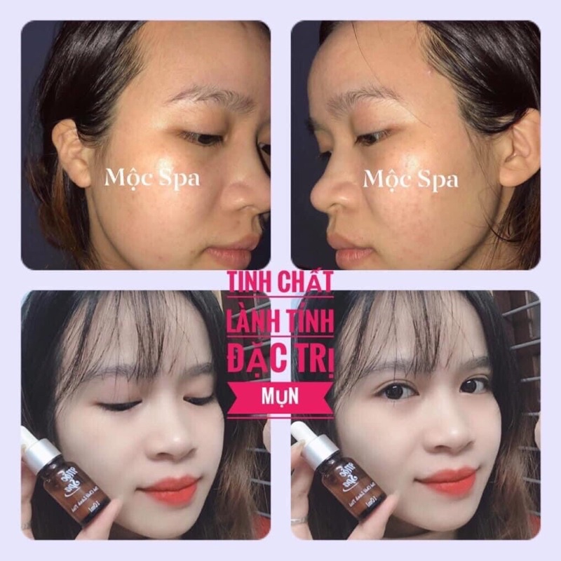 Tinh chất lành tính