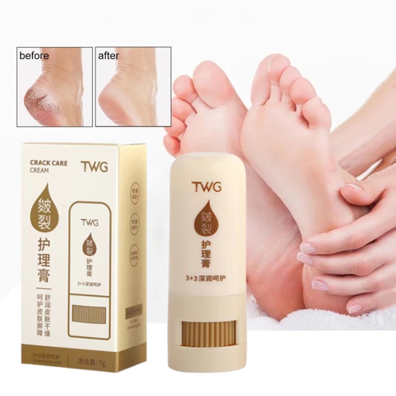 Kem Dưỡng Ẩm Chống Nứt Nẻ Da Tay Chân Tiện Lợi Dành Cho Mùa Thu Đông