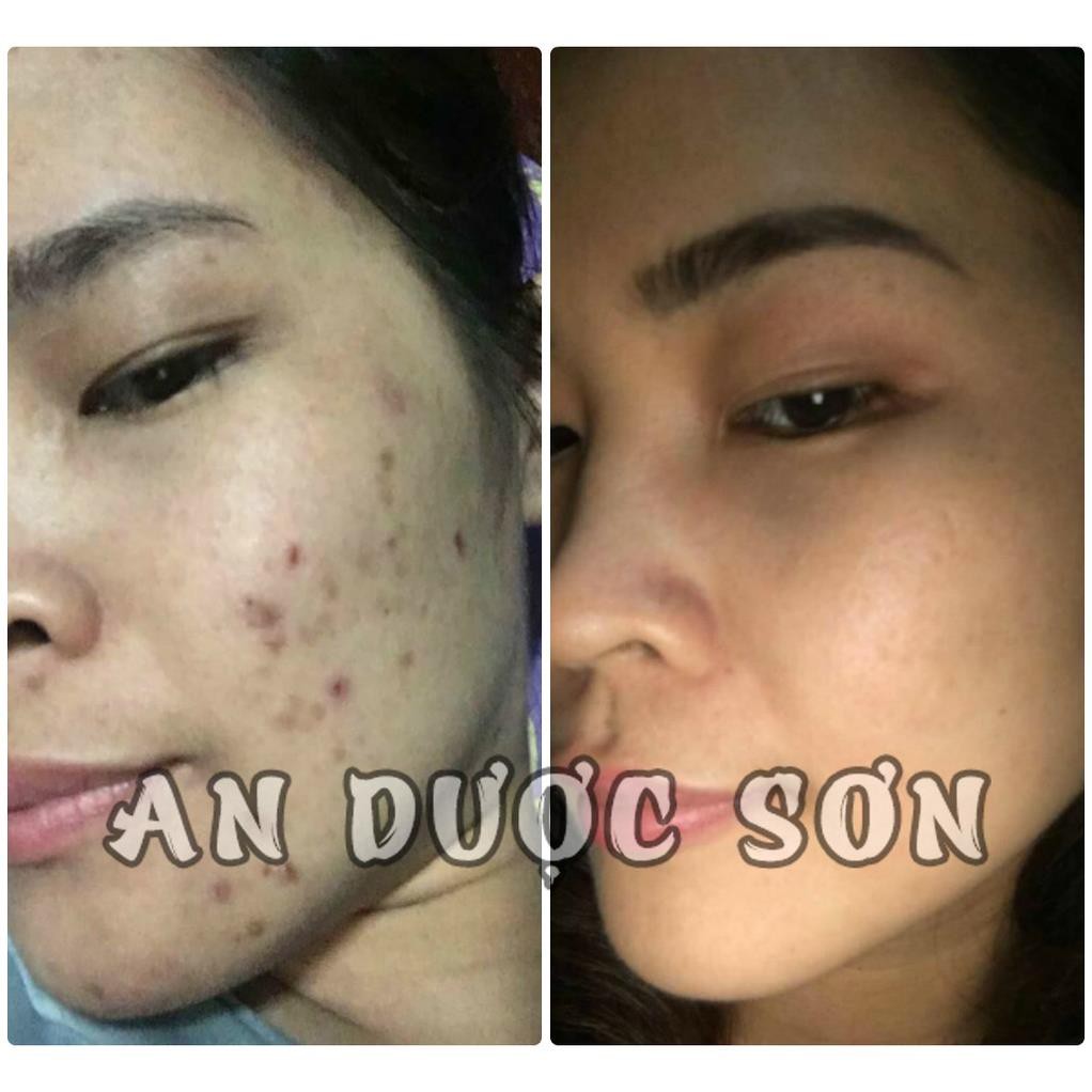 Bột thảo dược An Dược sơn