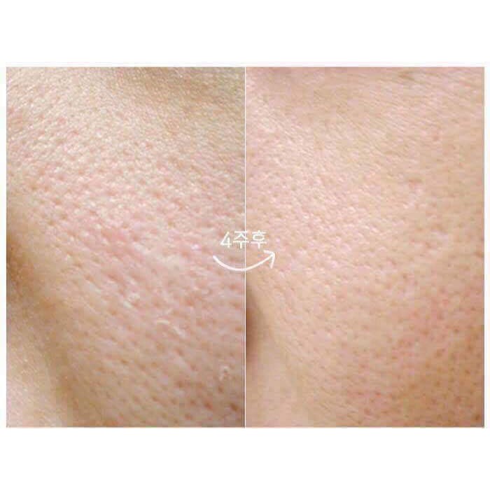 Tinh Chất Vitamin C Klairs Freshly Juiced Vitamin Drop