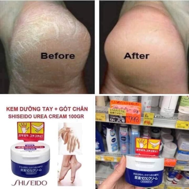 Kem trị nứt gót Chân BEST SELLER NhẬt