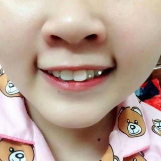 Combo đá đính răng tự đính