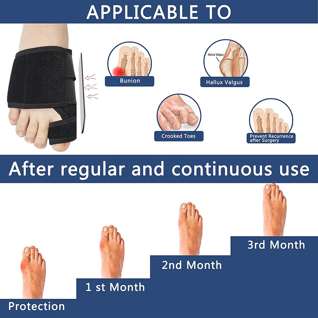 Set 2 Dụng Cụ Nẹp Chỉnh Hình Ngón Chân Mềm Mại Chăm Sóc Sức Khỏe