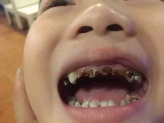 Tinh dầu chăm sóc răng miệng Lộc Phát Gia