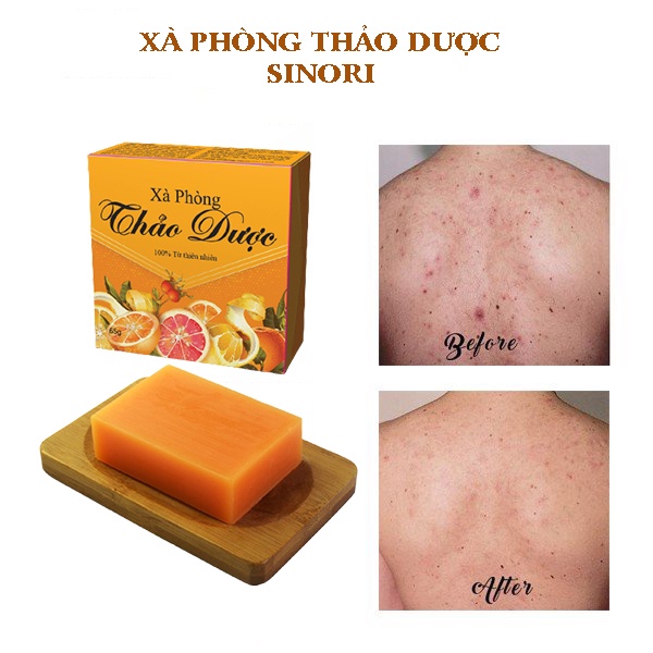 Bánh Tắm Thảo dược