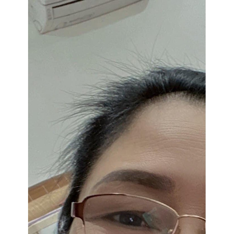 COMBO NGĂN RỤNG TÓC, KÍCH THÍCH MỌC TÓC H2A | BigBuy360 - bigbuy360.vn