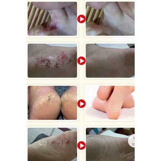 KEM NGỰA DƯỠNG DA