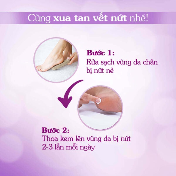 Kem Nứt Gót Oriss Soft And Heal 30G