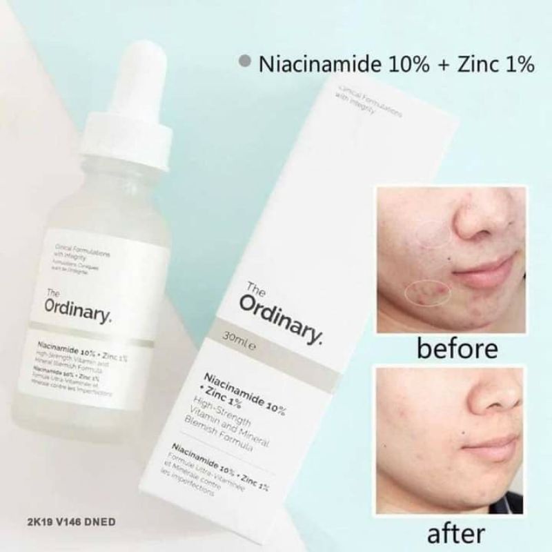 Serum the ordinary Niacinamide 10% + ZinC 1% 30ml