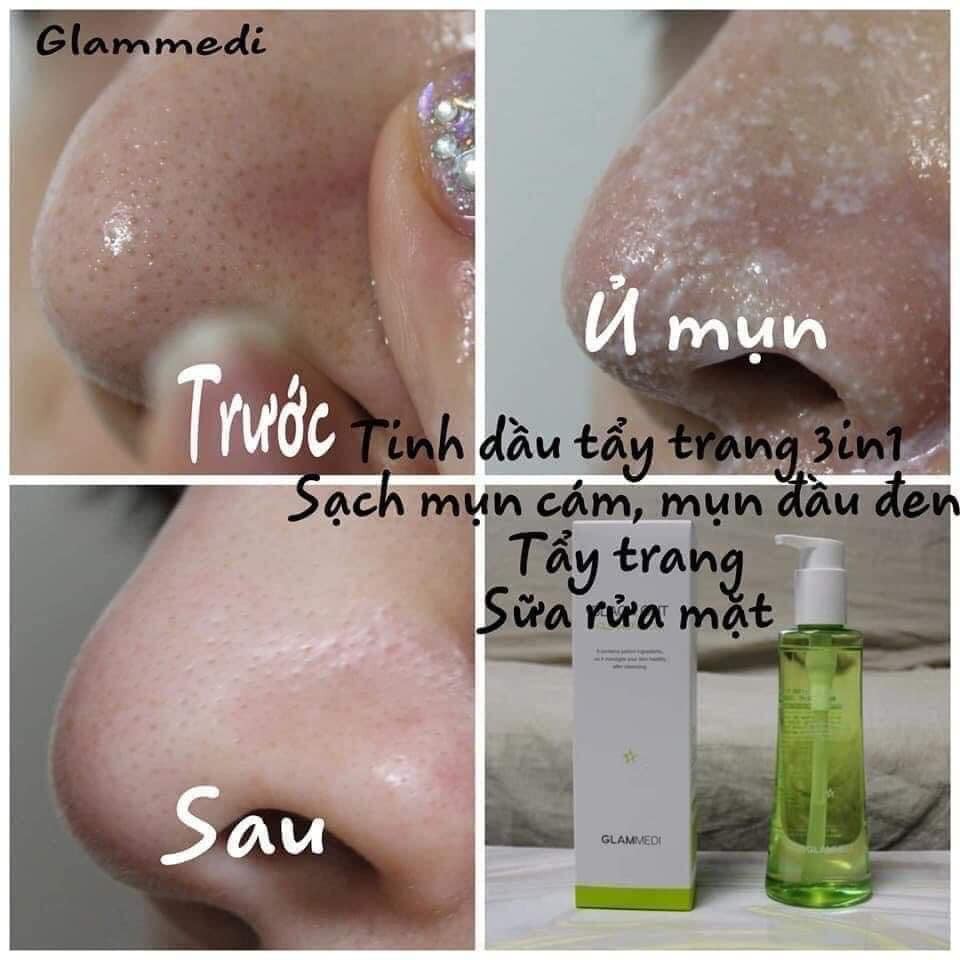 Dầu tẩy trang KÍCH Ủ MỤN ĐẦU ĐEN 3 in1 Glammedi Black Out Cleansing Oil