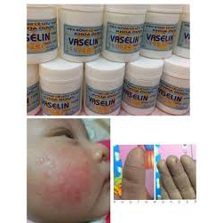 Vaselin dưỡng ẩm Viện Bỏng Quốc gia Lê Hữu Trác bôi mềm da chống hanh khô cho mẹ và bé an toàn chính hãng hàng chuẩn