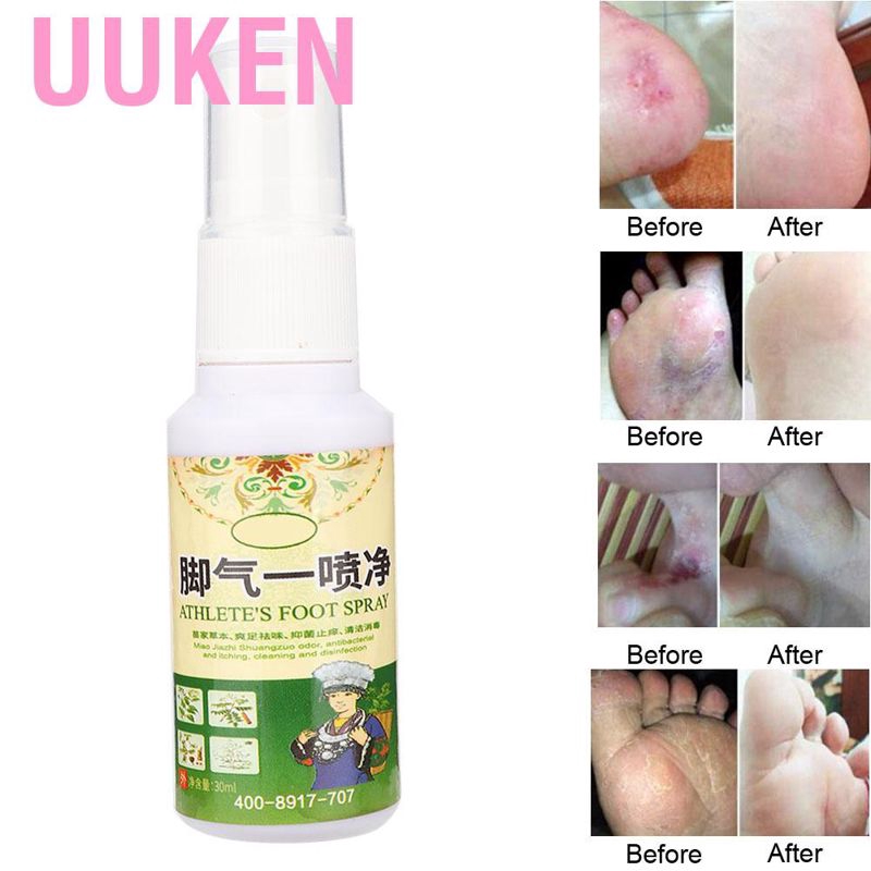 (Hàng Mới Về) Chai Xịt Khử Mùi Hôi Chân Chiết Xuất Thảo Dược 30ml