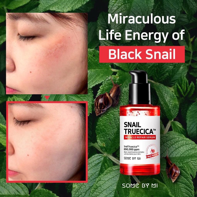 [Chính Hãng] Serum Ốc Sên Mờ Sẹo, Phục Hồi Da Snail Truecica Some By Mi Fullsize 50ml