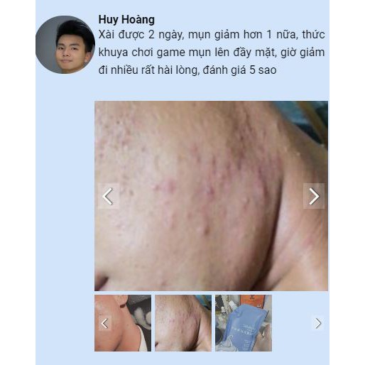 [Nội Địa Trung] - Mặt Nạ Gel Salicylic Acid Dung Tích 300ml Giúp Ngăn Ngừa Mụn Và Se Khít Lỗ Chân Lông