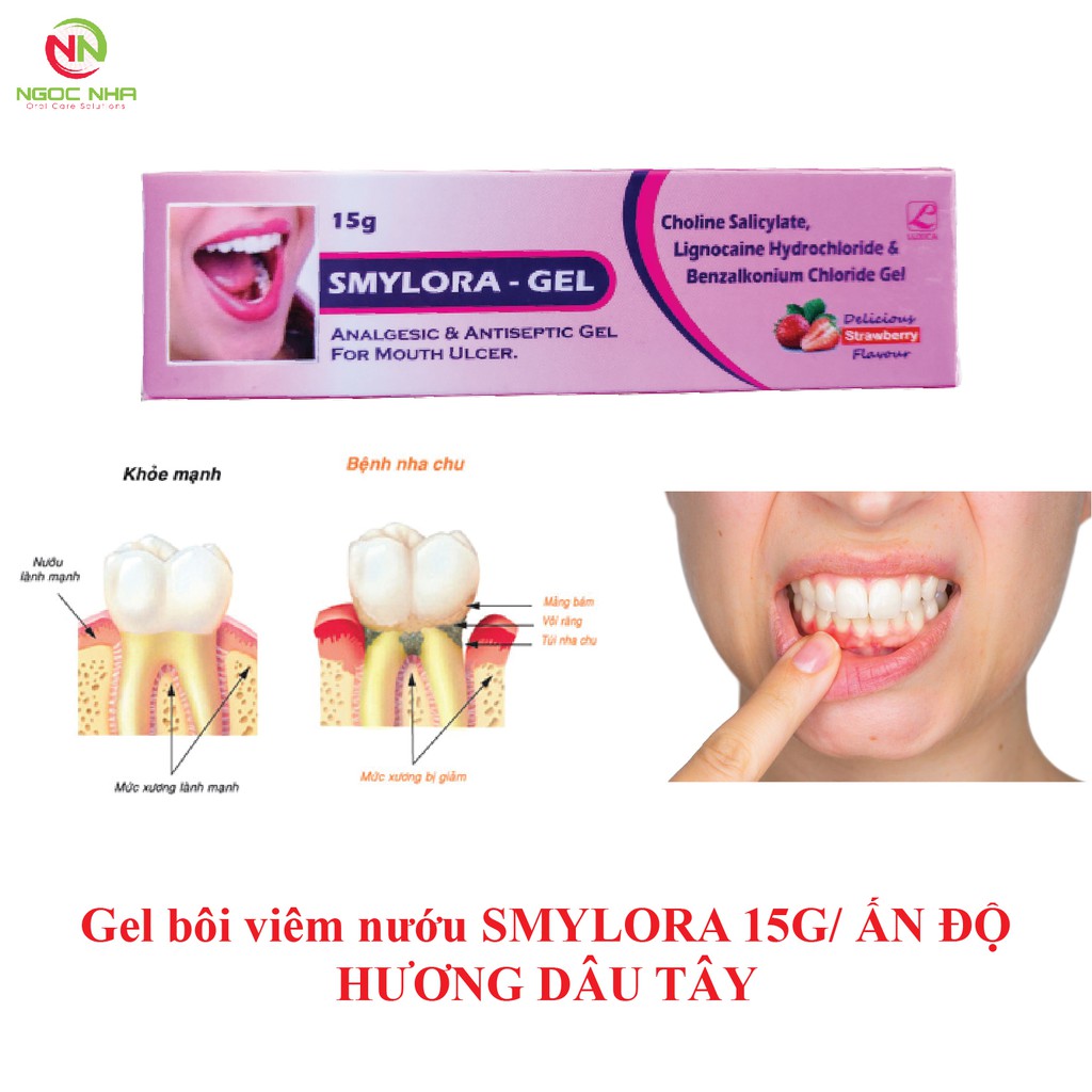 Gel bôi viêm nướu viêm nha chu Smylora 15/ Ấn Độ