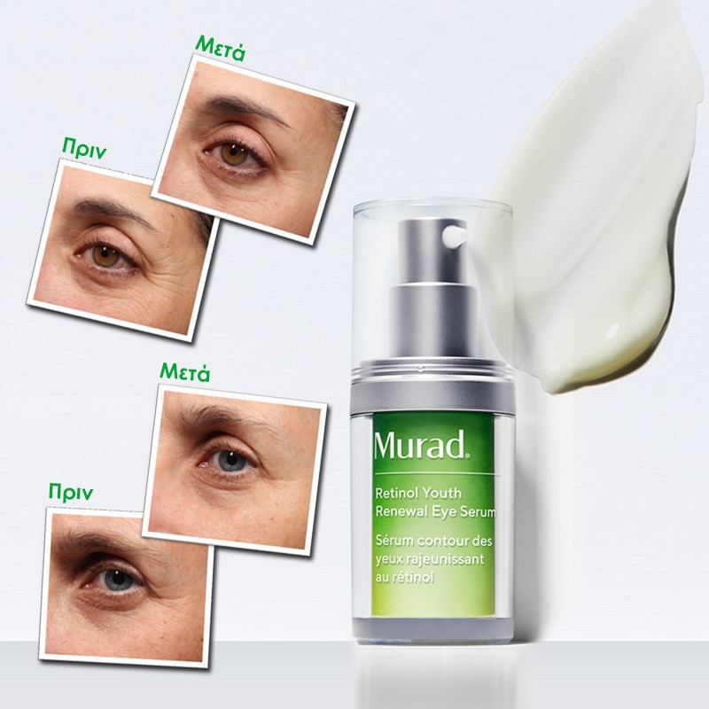 [Fullsize 15ML] Serum giảm thiểu nếp nhăn và bọng mắt Murad Retinol Youth Renewal Eye Serum