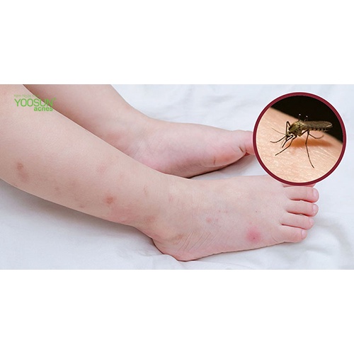 Serum dưỡng ngừa thâm chân tay ,nách bẹn mông 15ml