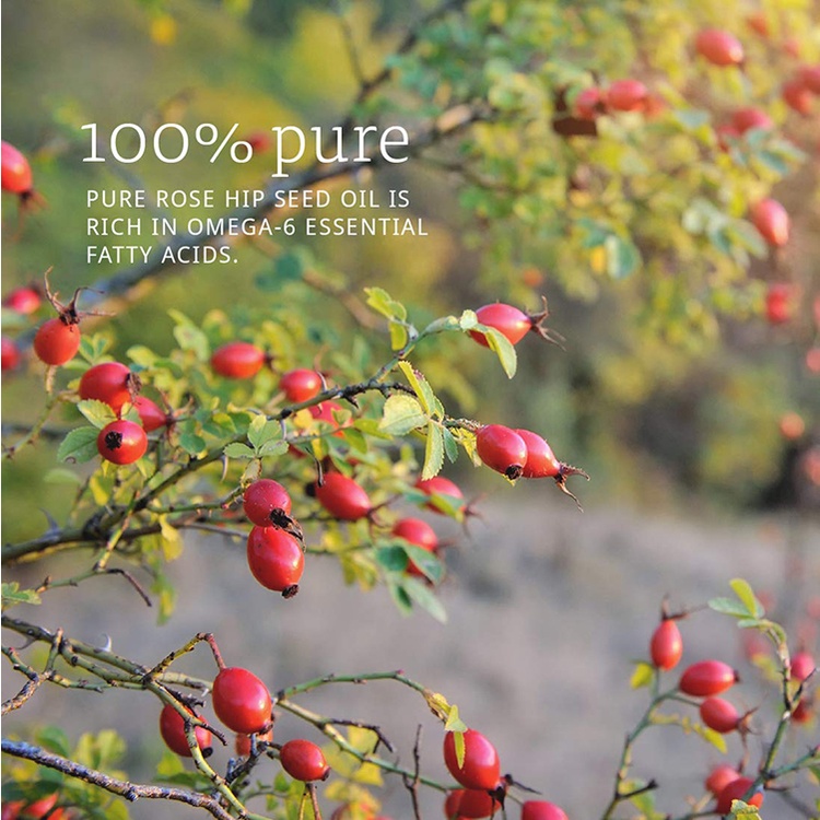 Dầu nụ tầm xuân Now Rosehip Seed Oil 30ml chuẩn USA | BigBuy360 - bigbuy360.vn