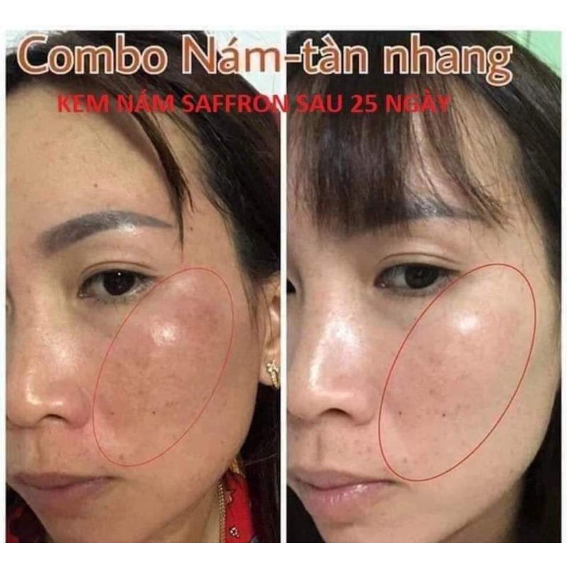 KEM NÁM SAFFRON 20GR HẢI ÂU VIỆT MẪU MỚI