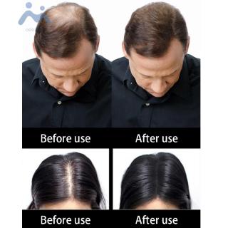 Bột Phủ Làm Dày Tóc Hiệu Quả