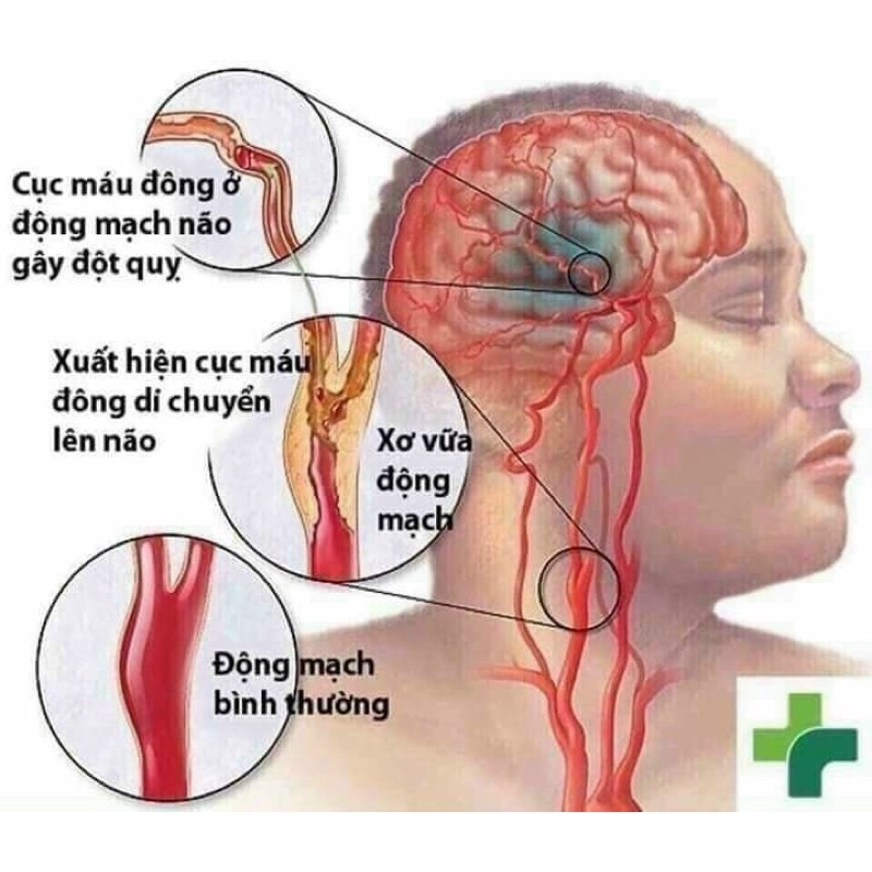 An Cung Ngưu Hoàng Hoàn Kwangdong Hàn Quốc Hộp Tổ Kén 10 viên Hàng Chuẩn Nội Địa