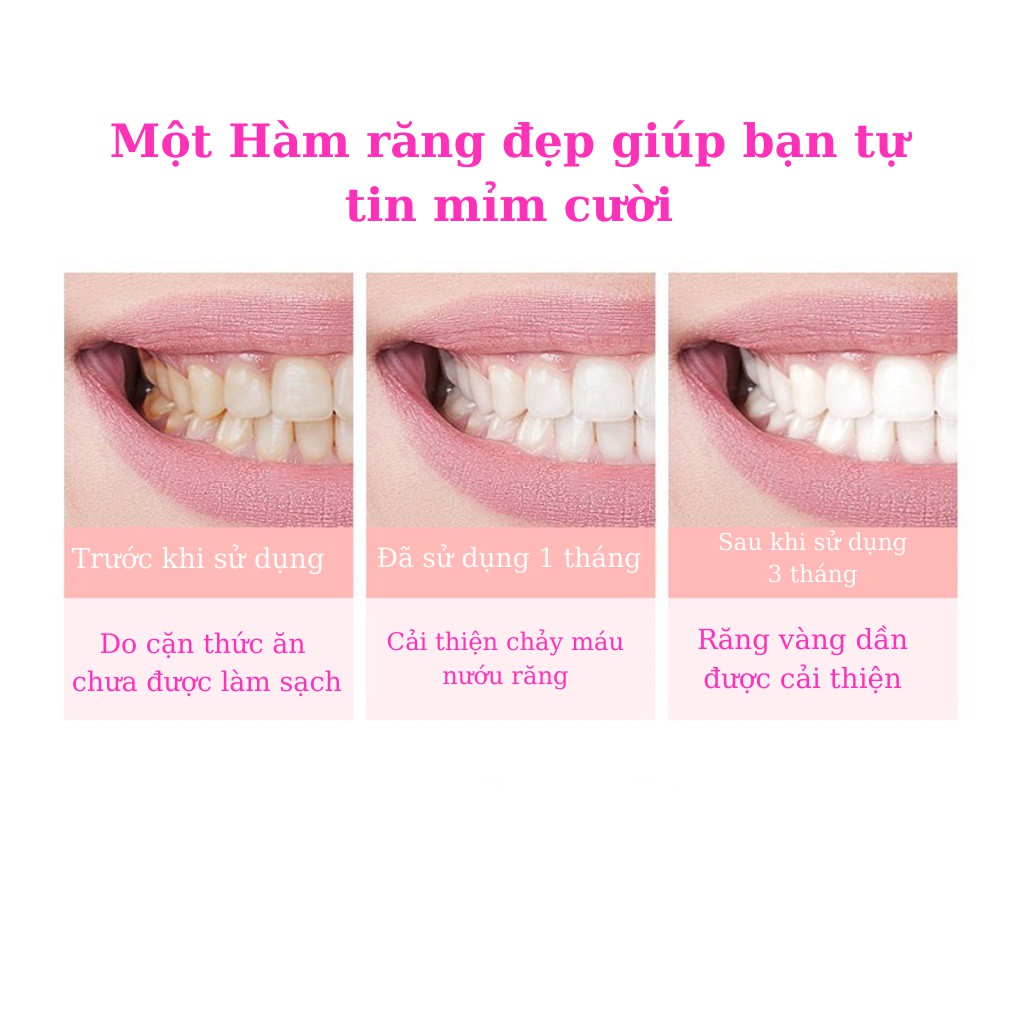 Bàn chải điện sử dụng pin, bàn trải điện đánh răng mềm tự động thông minh cao cấp