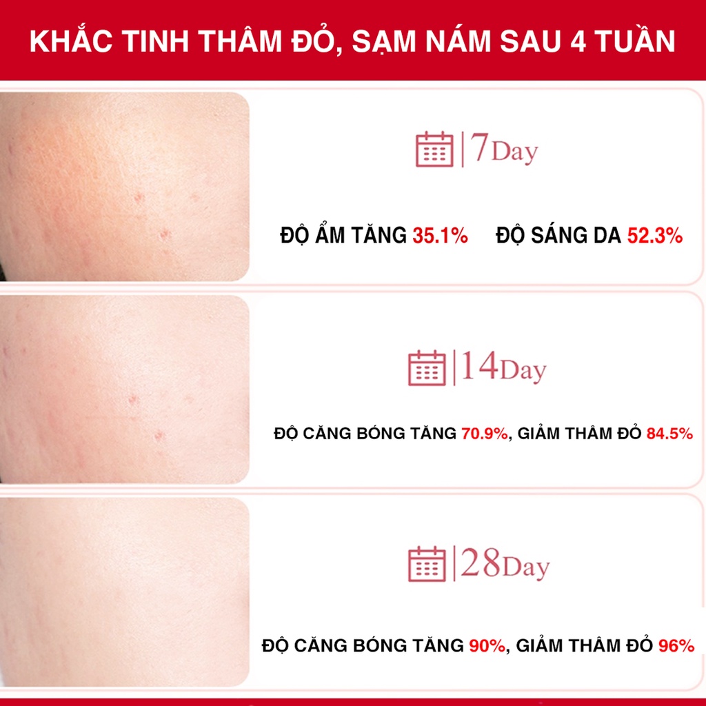 Tinh Chất Mờ Nám Angel's Liquid Tranexamic