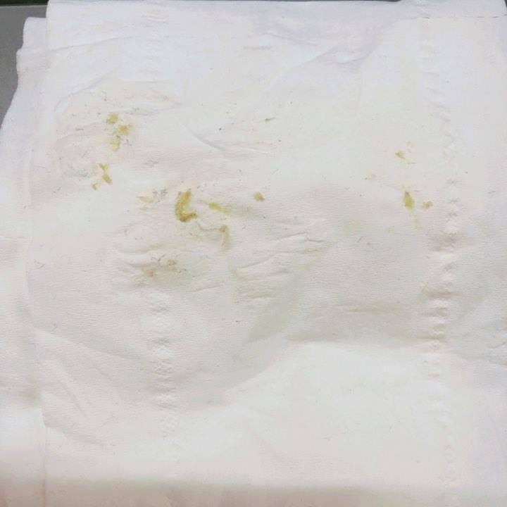 SON DƯỠNG CARMEX | BigBuy360 - bigbuy360.vn